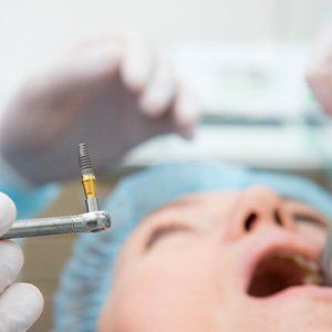 A man undergoing dental implant surgery