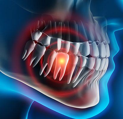 Animation with pained tooth highlighted