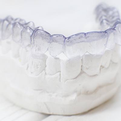 Invisalign on dental mold