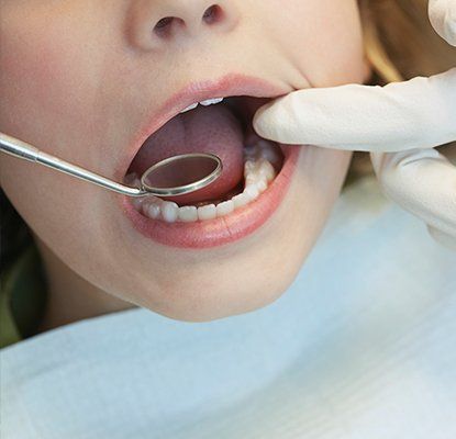 Closeup of child during dental exam