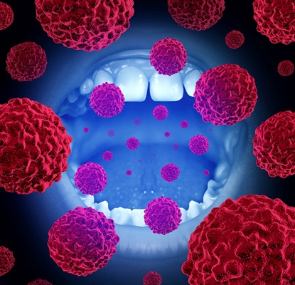 Oral cancer