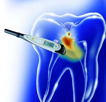 DIAGNOdent cavity detection tool