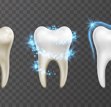 Illustration of teeth whitening