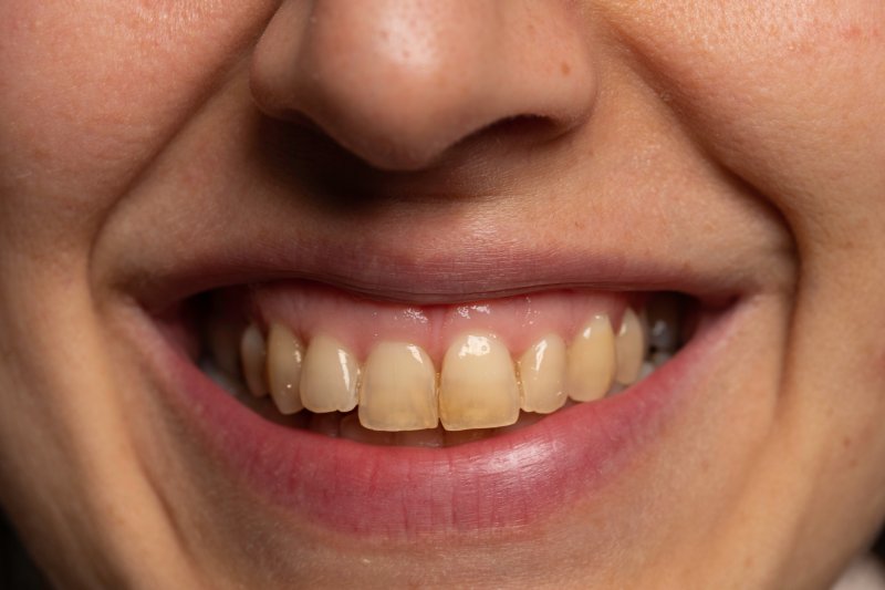 Closeup of a yellow smile