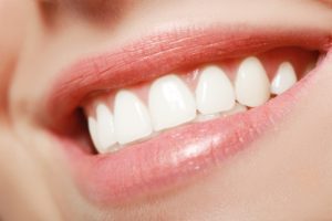 Close up of woman’s teeth with veneers